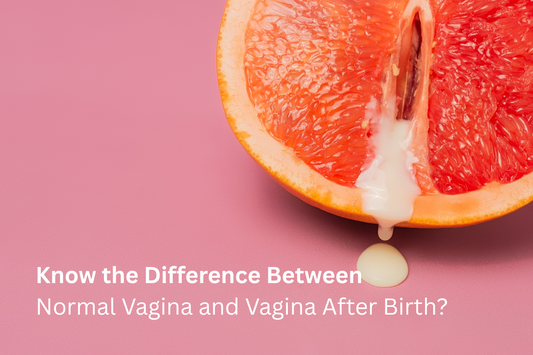 after birth vagina